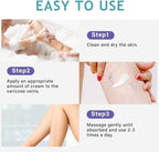 LIEVA & CO. Cream (Varicose Veins)