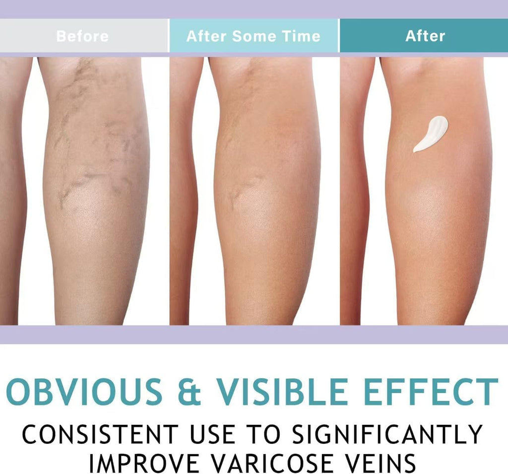 LIEVA & CO. Cream (Varicose Veins)