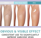 LIEVA & CO. Cream (Varicose Veins)