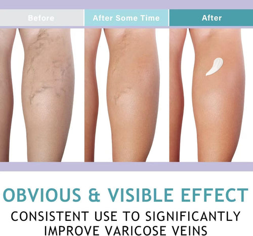 LIEVA & CO. Cream (Varicose Veins)